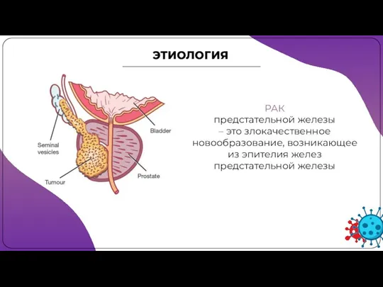 РАК предстательной железы – это злокачественное новообразование, возникающее из эпителия желез предстательной железы ЭТИОЛОГИЯ