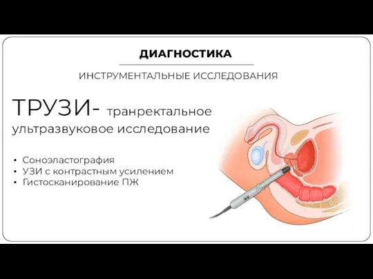 ДИАГНОСТИКА ИНСТРУМЕНТАЛЬНЫЕ ИССЛЕДОВАНИЯ ТРУЗИ- транректальное ультразвуковое исследование Соноэластография УЗИ с контрастным усилением Гистосканирование ПЖ