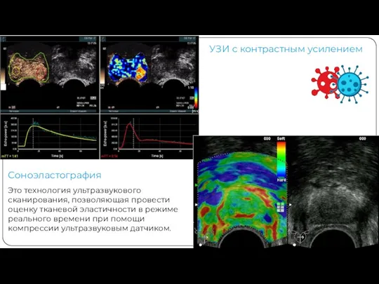 УЗИ с контрастным усилением Соноэластография Это технология ультразвукового сканирования, позволяющая провести оценку