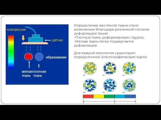 Определение жесткости ткани стало возможным благодаря различной степени деформации ткани: -Плотную ткань