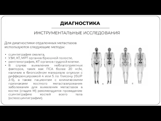 ДИАГНОСТИКА ИНСТРУМЕНТАЛЬНЫЕ ИССЛЕДОВАНИЯ Для диагностики отдаленных метастазов используются следующие методы: сцинтиграфия скелета,