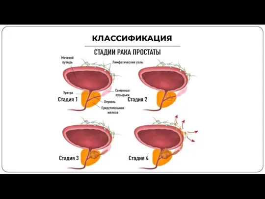 КЛАССИФИКАЦИЯ