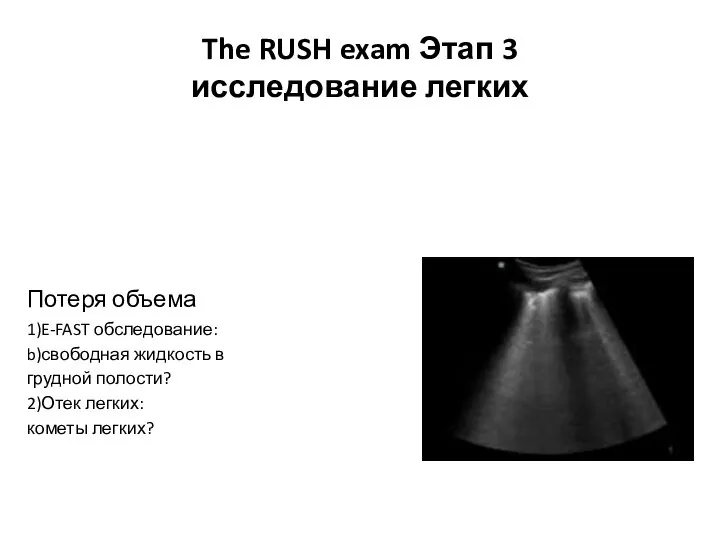 The RUSH exam Этап 3 исследование легких Потеря объема 1)E-FAST обследование: b)свободная