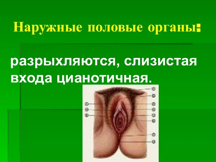 Наружные половые органы: разрыхляются, слизистая входа цианотичная.