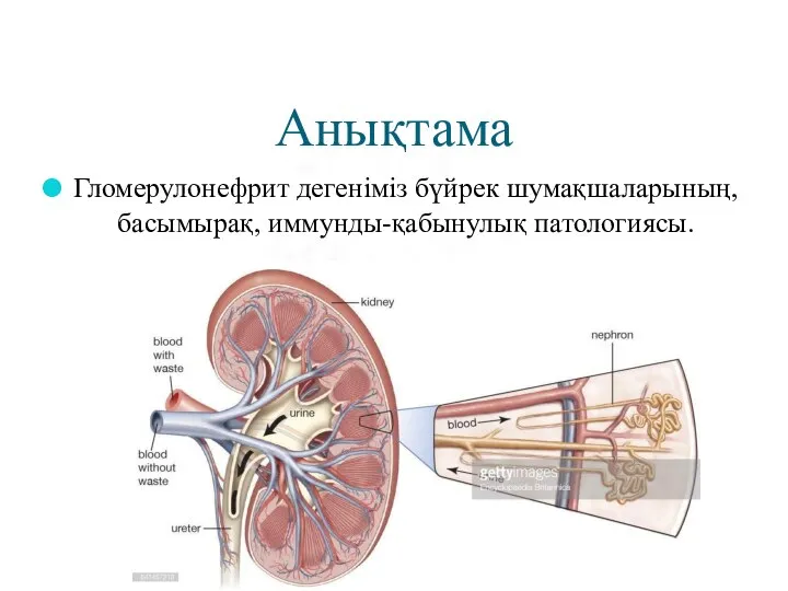 Анықтама Гломерулонефрит дегеніміз бүйрек шумақшаларының, басымырақ, иммунды-қабынулық патологиясы.