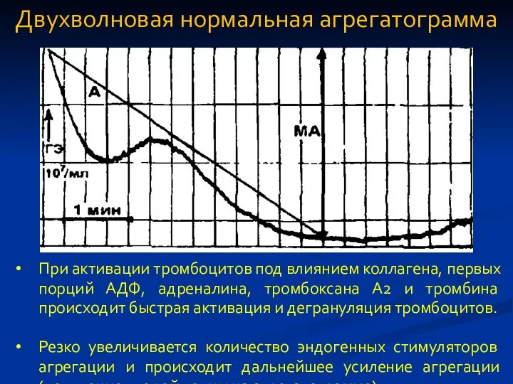 Двухволновая нормальная агрегатограмма При активации тромбоцитов под влиянием коллагена, первых порций АДФ,