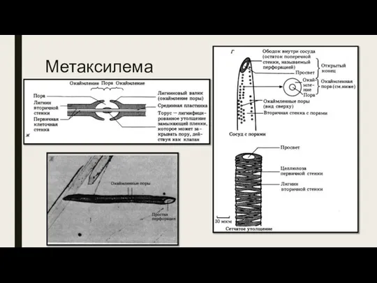 Метаксилема