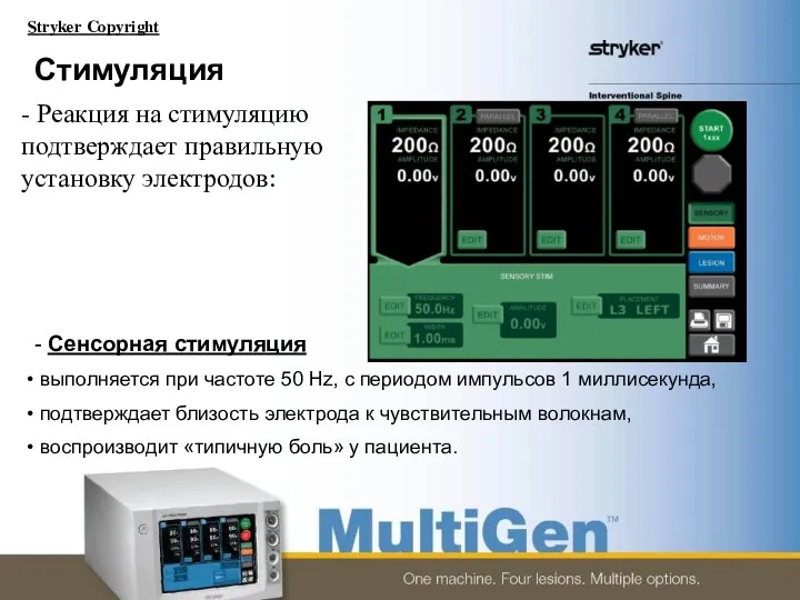 Стимуляция - Сенсорная стимуляция выполняется при частоте 50 Hz, с периодом импульсов