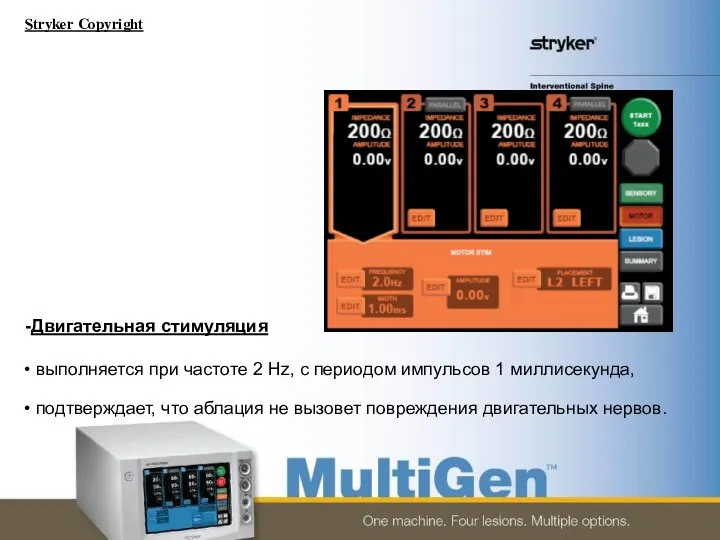 Двигательная стимуляция выполняется при частоте 2 Hz, с периодом импульсов 1 миллисекунда,