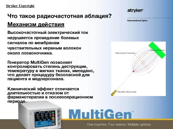 Что такое радиочастотная аблация? Механизм действия Высокочастотный электрический ток нарушается проведение болевых