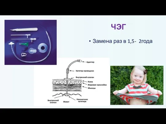 ЧЭГ Замена раз в 1,5- 2года