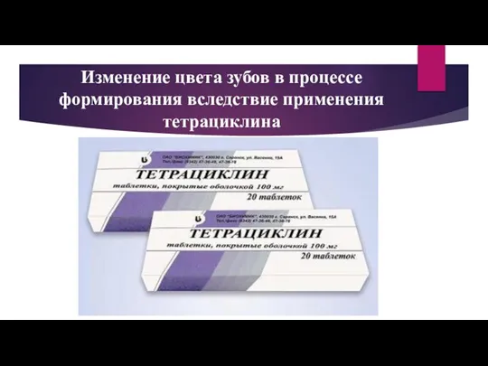 Изменение цвета зубов в процессе формирования вследствие применения тетрациклина