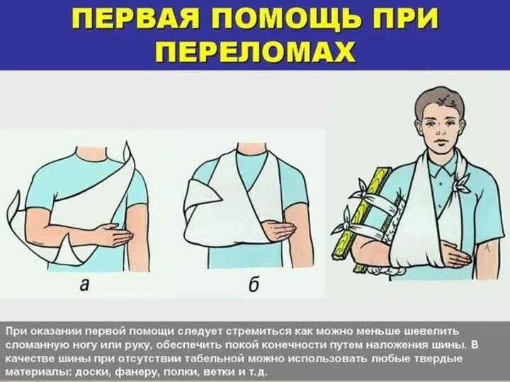 Повреждения опорной системы