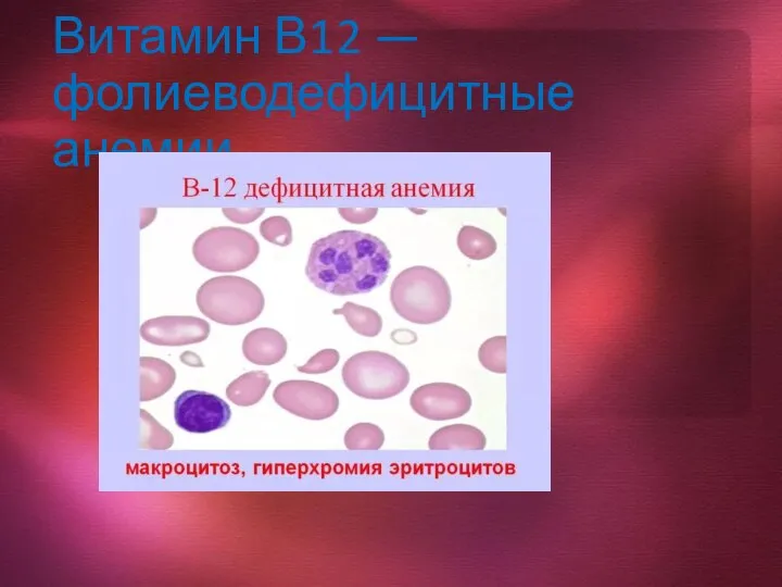 Витамин В12 — фолиеводефицитные анемии
