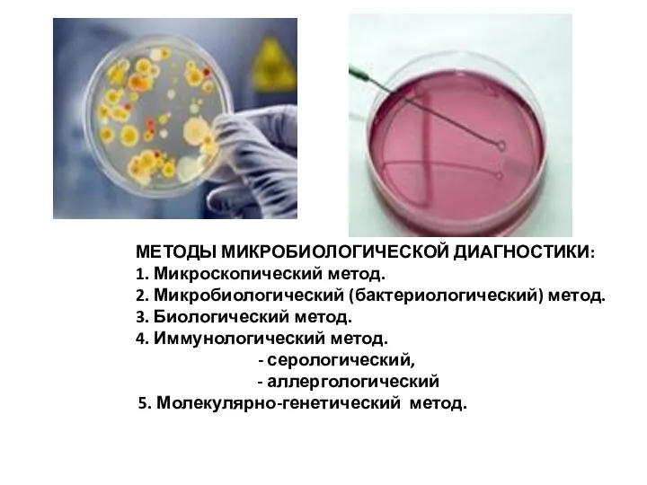 МЕТОДЫ МИКРОБИОЛОГИЧЕСКОЙ ДИАГНОСТИКИ: 1. Микроскопический метод. 2. Микробиологический (бактериологический) метод. 3. Биологический