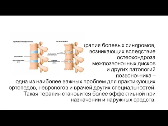 Терапия болевых синдромов, возникающих вследствие остеохондроза межпозвоночных дисков и других патологий позвоночника