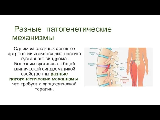 Разные патогенетические механизмы Одним из сложных аспектов артрологии является диагностика суставного синдрома.