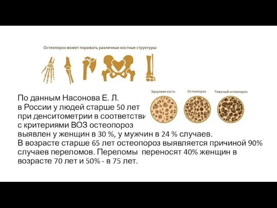 По данным Насонова Е. Л. в России у людей старше 50 лет