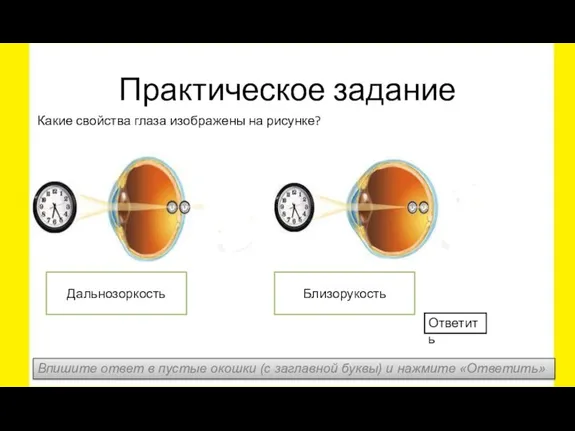 Практическое задание Какие свойства глаза изображены на рисунке? Близорукость Дальнозоркость Впишите ответ