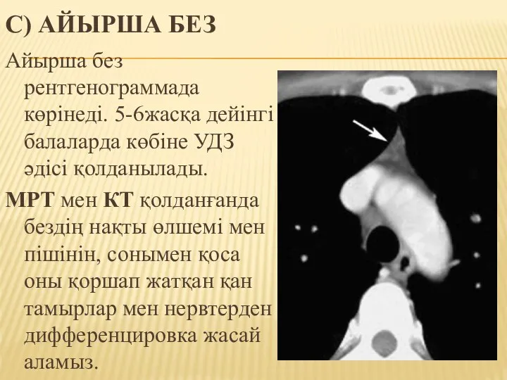 C) АЙЫРША БЕЗ Айырша без рентгенограммада көрінеді. 5-6жасқа дейінгі балаларда көбіне УДЗ