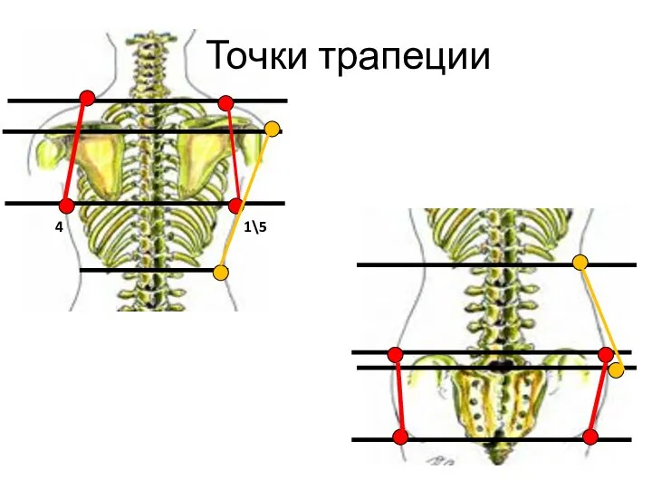 Точки трапеции 1\5 4