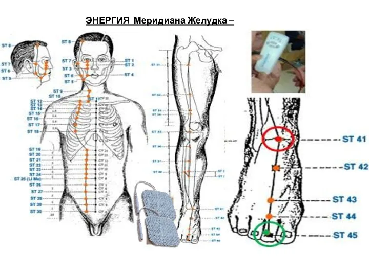 ЭНЕРГИЯ Меридиана Желудка – F6/ ST