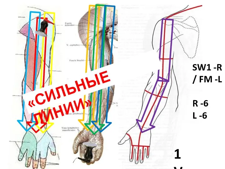 1 Var. SW1 -R / FM -L R -6 L -6 «СИЛЬНЫЕ ЛИНИИ»