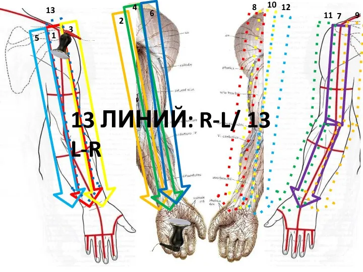 0 1 13 ЛИНИЙ: R-L/ 13 L-R 1 2 3 4 5