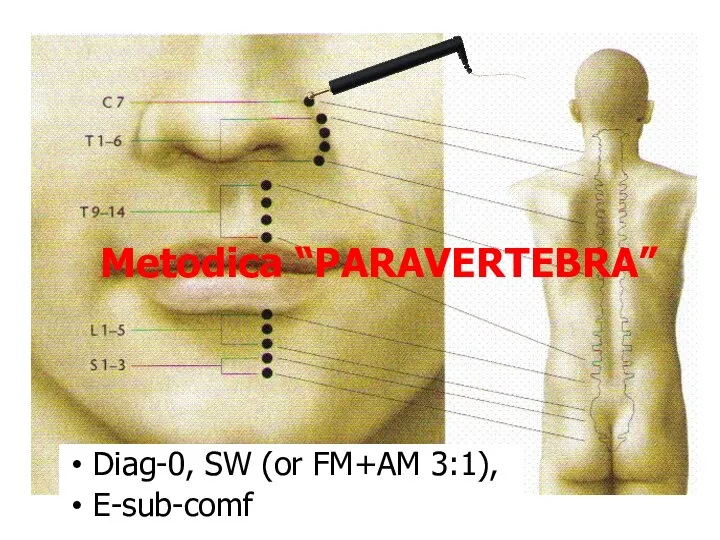 Metodica “PARAVERTEBRA” Diag-0, SW (or FM+AM 3:1), E-sub-comf