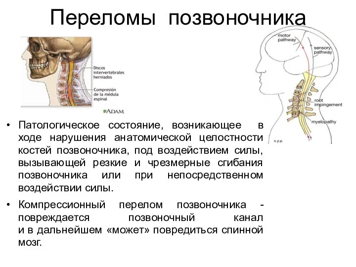 Переломы позвоночника Патологическое состояние, возникающее в ходе нарушения анатомической целостности костей позвоночника,