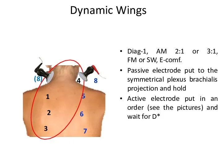 Dynamic Wings 8 5 6 7 (8) Diag-1, AM 2:1 or 3:1,