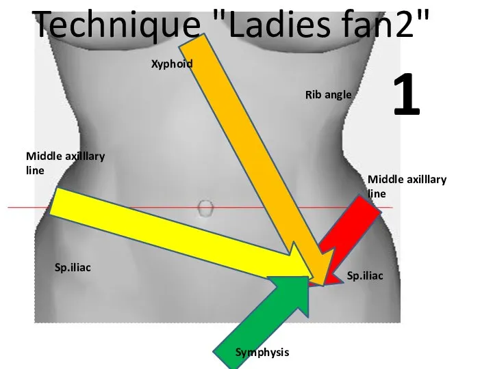 1 Rib angle Xyphoid Sp.iliac Sp.iliac Symphysis Technique "Ladies fan2" Middle axilllary line Middle axilllary line