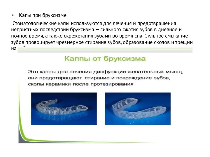 Капы при бруксизме. Стоматологические капы используются для лечения и предотвращения неприятных последствий