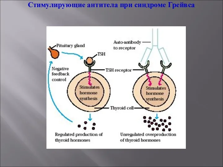 Стимулирующие антитела при синдроме Грейвса