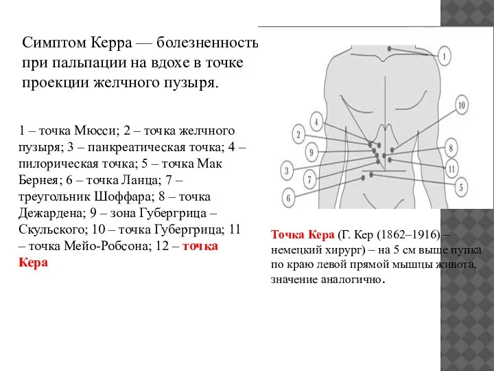 Симптом Керра — болезненность при пальпации на вдохе в точке проекции желчного