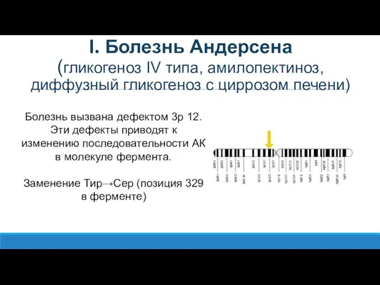 I. Болезнь Андерсена (гликогеноз IV типа, амилопектиноз, диффузный гликогеноз с циррозом печени)