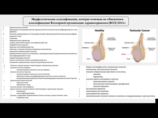 Морфологическая классификация, которая основана на обновлении классификации Всемирной организации здравоохранения (ВОЗ) 2016 г