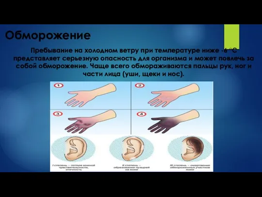 Обморожение Пребывание на холодном ветру при температуре ниже -6 °С представляет серьезную