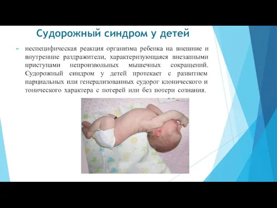 Судорожный синдром у детей неспецифическая реакция организма ребенка на внешние и внутренние