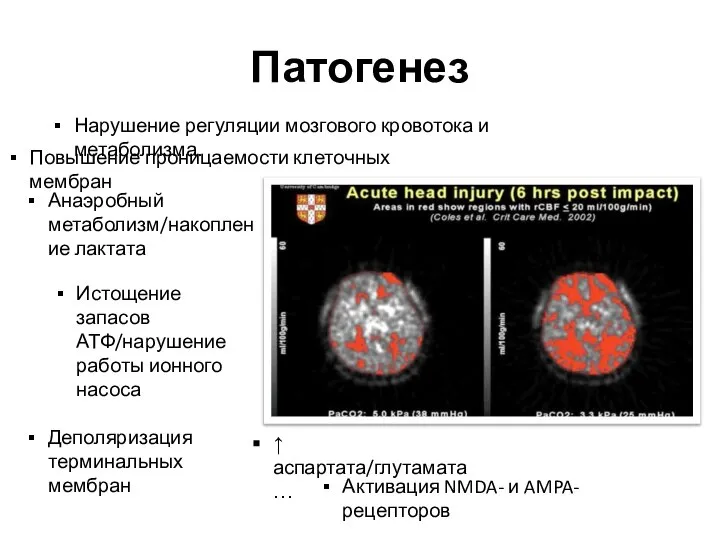 Патогенез Нарушение регуляции мозгового кровотока и метаболизма. Повышение проницаемости клеточных мембран Анаэробный