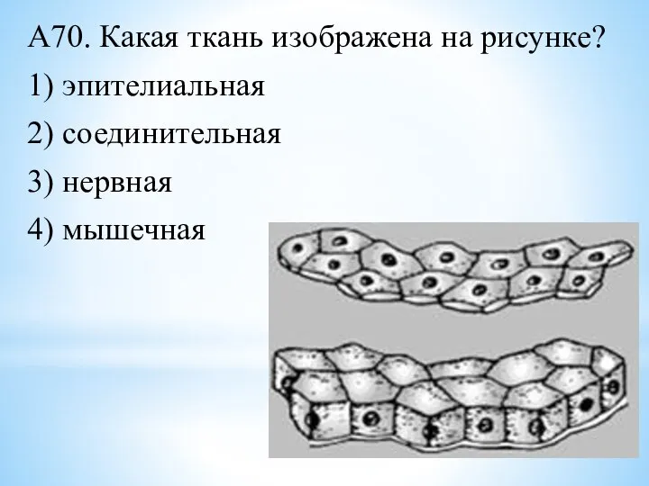 А70. Какая ткань изображена на рисунке? 1) эпителиальная 2) соединительная 3) нервная 4) мышечная