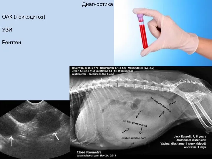 Диагностика: ОАК (лейкоцитоз) УЗИ Рентген