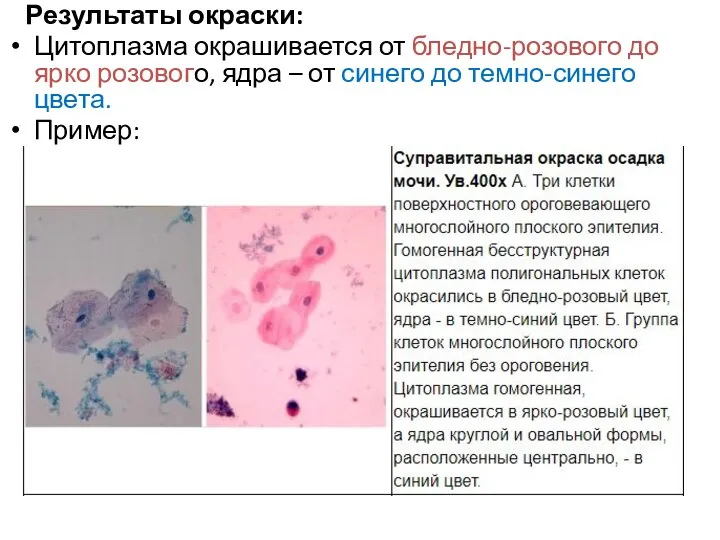 Результаты окраски: Цитоплазма окрашивается от бледно-розового до ярко розового, ядра – от