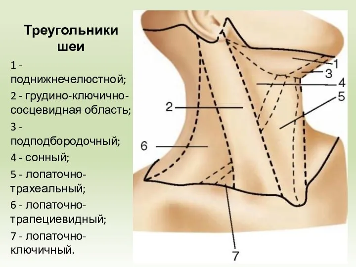 Треугольники шеи 1 -поднижнечелюстной; 2 - грудино-ключично-сосцевидная область; 3 - подподбородочный; 4