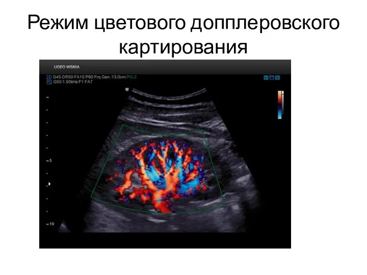 Режим цветового допплеровского картирования