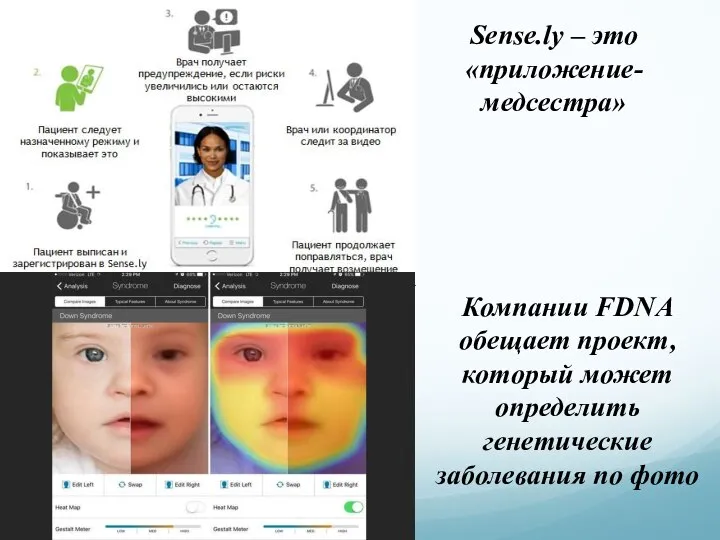 Sense.ly – это «приложение-медсестра» Компании FDNA обещает проект, который может определить генетические заболевания по фото