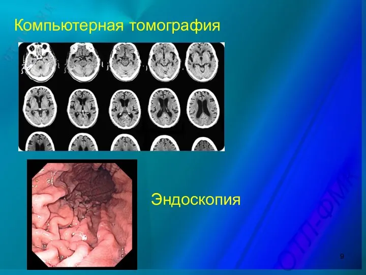 Компьютерная томография Эндоскопия