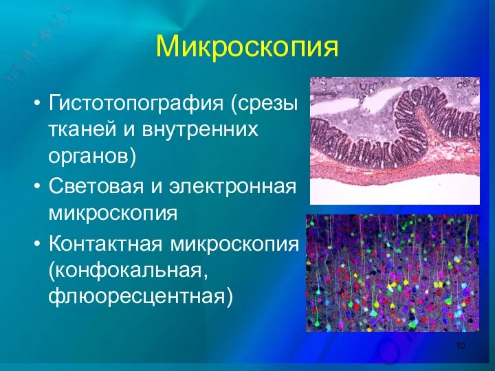 Микроскопия Гистотопография (срезы тканей и внутренних органов) Световая и электронная микроскопия Контактная микроскопия (конфокальная, флюоресцентная)