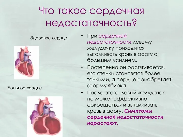 Что такое сердечная недостаточность? При сердечной недостаточности левому желудочку приходится выталкивать кровь