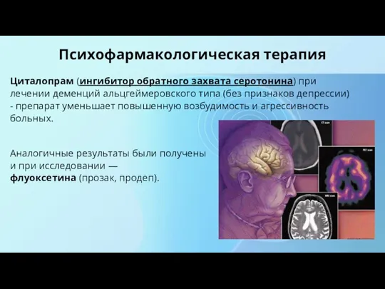 Психофармакологическая терапия Циталопрам (ингибитор обратного захвата серотонина) при лечении деменций альцгеймеровского типа